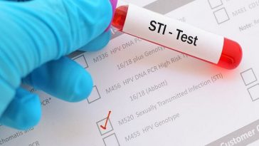 STI-Testing